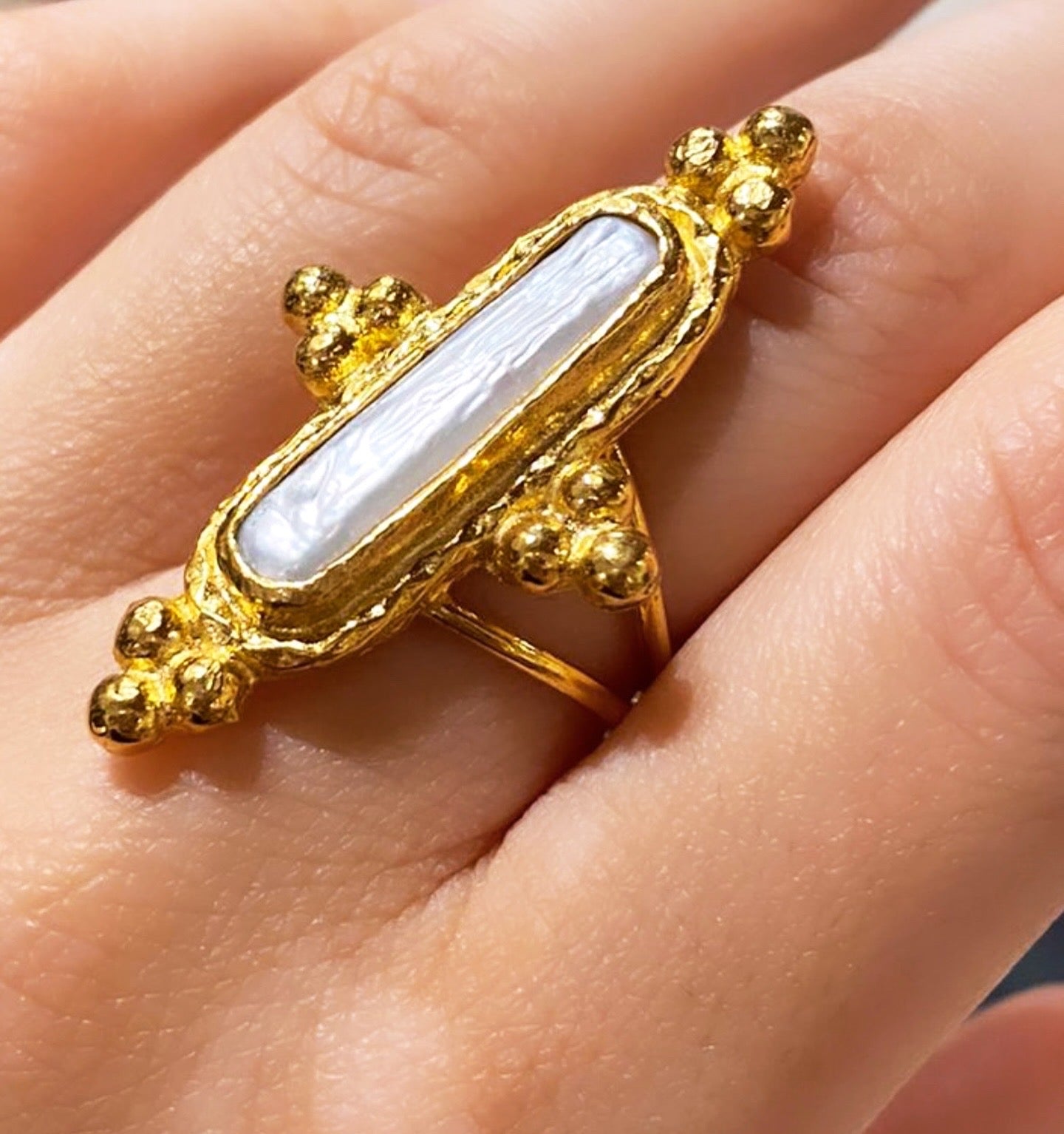 Anello Noto